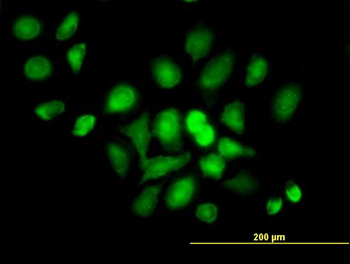 DDX20 MaxPab mouse polyclonal antibody (B01)