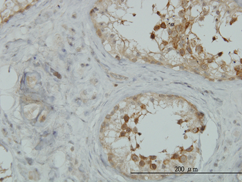 AKAP10 monoclonal antibody (M04), clone 8C10