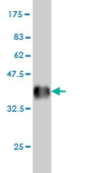 AKAP10 monoclonal antibody (M04), clone 8C10