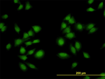 AKAP13 monoclonal antibody (M01), clone 5B7