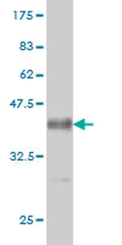 AKAP13 monoclonal antibody (M01), clone 5B7