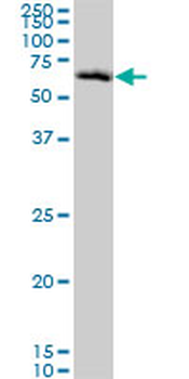 CHEK2 monoclonal antibody (M01), clone 4B7