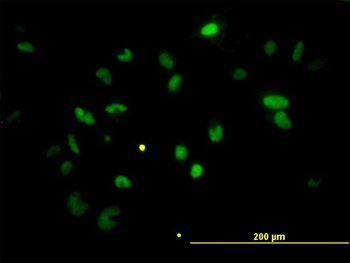 CHEK2 monoclonal antibody (M01), clone 4B7