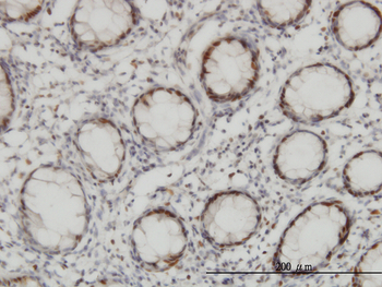 CHEK2 monoclonal antibody (M01), clone 4B7