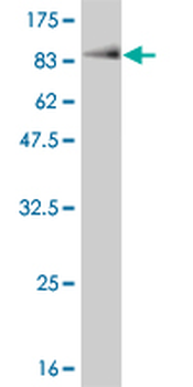 CHEK2 monoclonal antibody (M01), clone 4B7