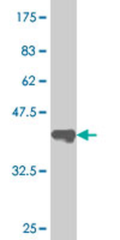 SUPT16H monoclonal antibody (M01), clone 1D12