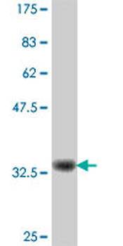LZTS1 polyclonal antibody (A01)