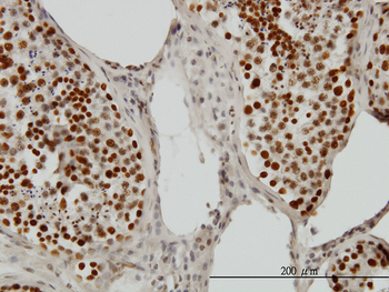PSIP1 monoclonal antibody (M01), clone 3H1