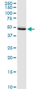 PSIP1 monoclonal antibody (M01), clone 3H1