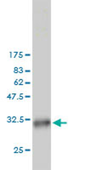 PSIP1 monoclonal antibody (M01), clone 3H1