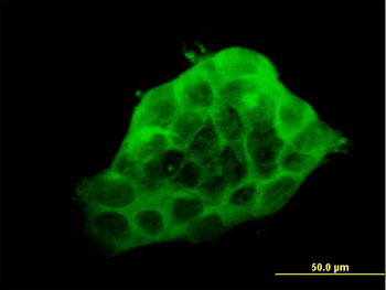 LDB3 monoclonal antibody (M06), clone 3C8