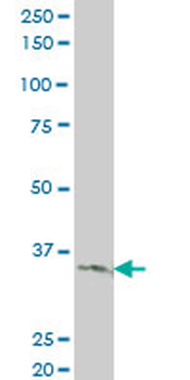 LDB3 monoclonal antibody (M06), clone 3C8