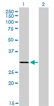 LDB3 monoclonal antibody (M06), clone 3C8