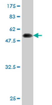 LDB3 monoclonal antibody (M06), clone 3C8