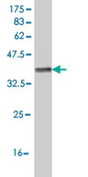 IL1RAPL1 monoclonal antibody (M04), clone 1C10