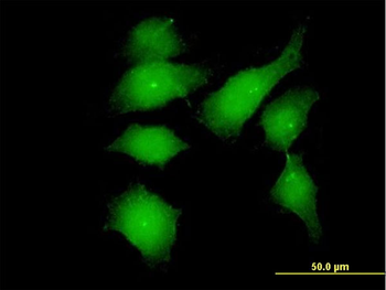 FGFR1OP monoclonal antibody (M01), clone 2B1