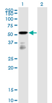 FGFR1OP monoclonal antibody (M01), clone 2B1
