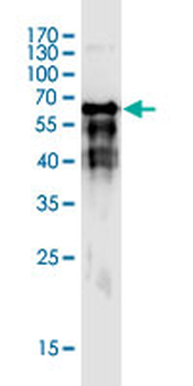 FGFR1OP monoclonal antibody (M01), clone 2B1