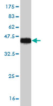 ADAMTS8 monoclonal antibody (M01), clone 5A3