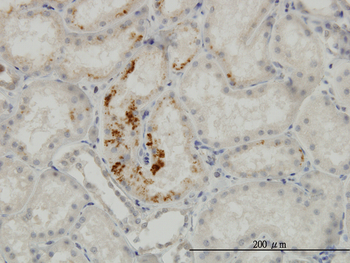 ESM1 monoclonal antibody (M02), clone 6D4