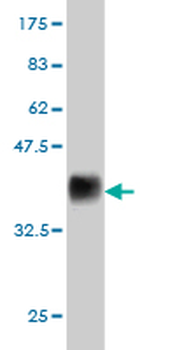 ESM1 monoclonal antibody (M02), clone 6D4