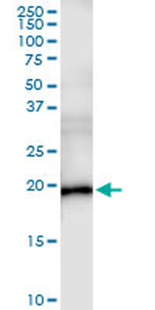 ESM1 MaxPab rabbit polyclonal antibody (D01)