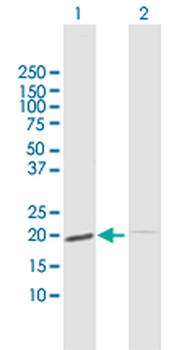 ESM1 MaxPab rabbit polyclonal antibody (D01)