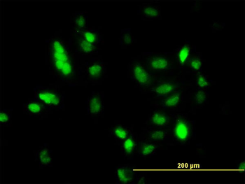 UBE2C monoclonal antibody (M01), clone 9D3
