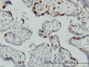 UBE2C monoclonal antibody (M01), clone 9D3