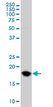 UBE2C monoclonal antibody (M01), clone 9D3