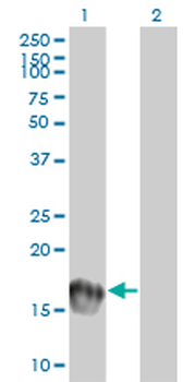UBE2C monoclonal antibody (M01), clone 9D3