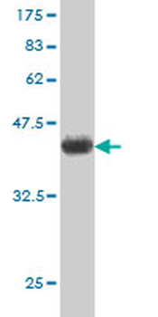 UBE2C monoclonal antibody (M01), clone 9D3