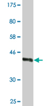 WWP1 monoclonal antibody (M01A), clone 1A7