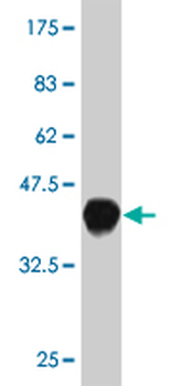WWP1 monoclonal antibody (M01), clone 1A7