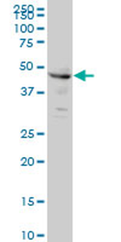 CPSF6 monoclonal antibody (M10), clone 3F11