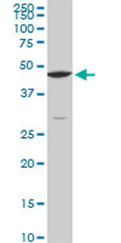 CPSF6 monoclonal antibody (M10), clone 3F11