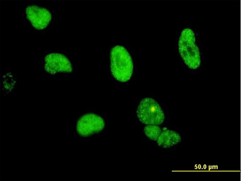 CPSF6 monoclonal antibody (M10), clone 3F11