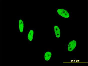 NUDT21 monoclonal antibody (M12), clone 3F8
