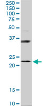 RAB31 monoclonal antibody (M03), clone 4D12