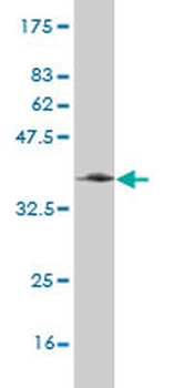 RAB31 monoclonal antibody (M03), clone 4D12
