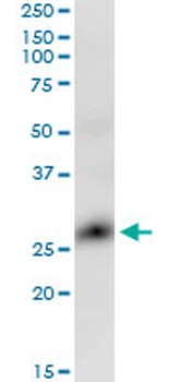 GLIPR1 monoclonal antibody (M04), clone 8D9