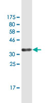 GLIPR1 monoclonal antibody (M04), clone 8D9