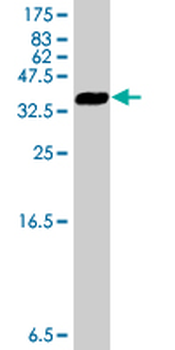 GLIPR1 polyclonal antibody (A01)
