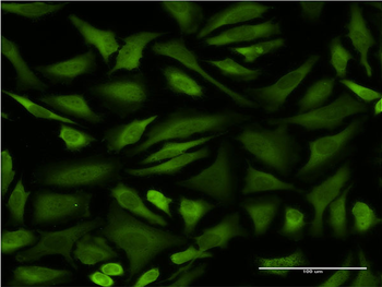 STIP1 monoclonal antibody (M06), clone 1C6