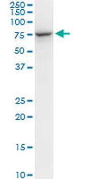 STIP1 monoclonal antibody (M06), clone 1C6