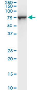 STIP1 monoclonal antibody (M06), clone 1C6