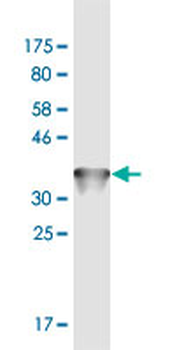 STIP1 monoclonal antibody (M06), clone 1C6