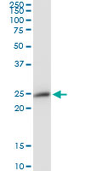 PRDX3 MaxPab mouse polyclonal antibody (B01)