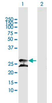 PRDX3 MaxPab mouse polyclonal antibody (B01)