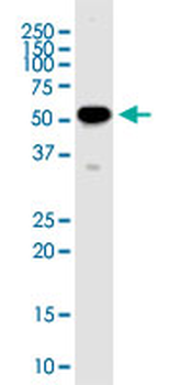 RNPS1 monoclonal antibody (M05), clone 7G8